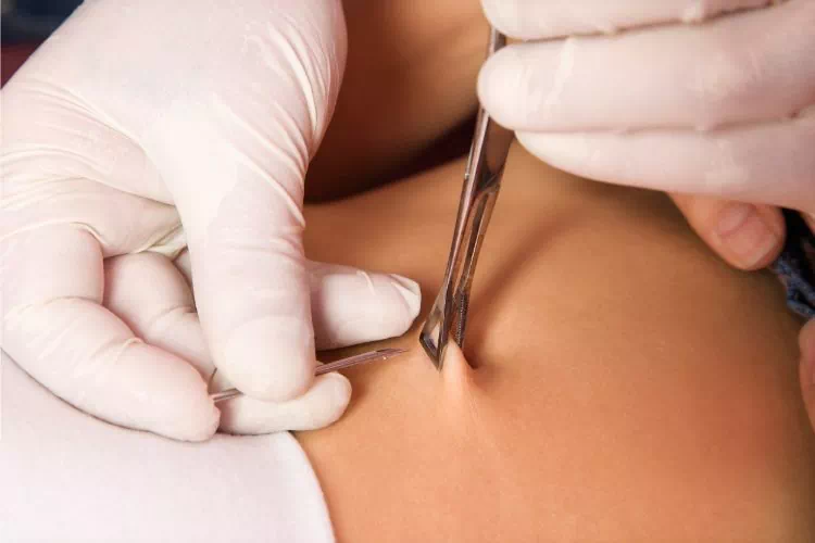 Personne en train de faire un piercing du nombril